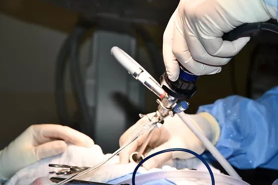 Urinary bladder stone removal