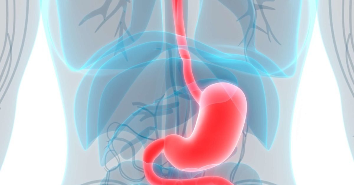 Dilatation and Stenting
