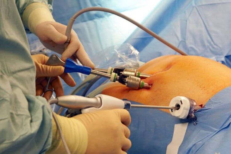 Gastrointestinal tract malignancy