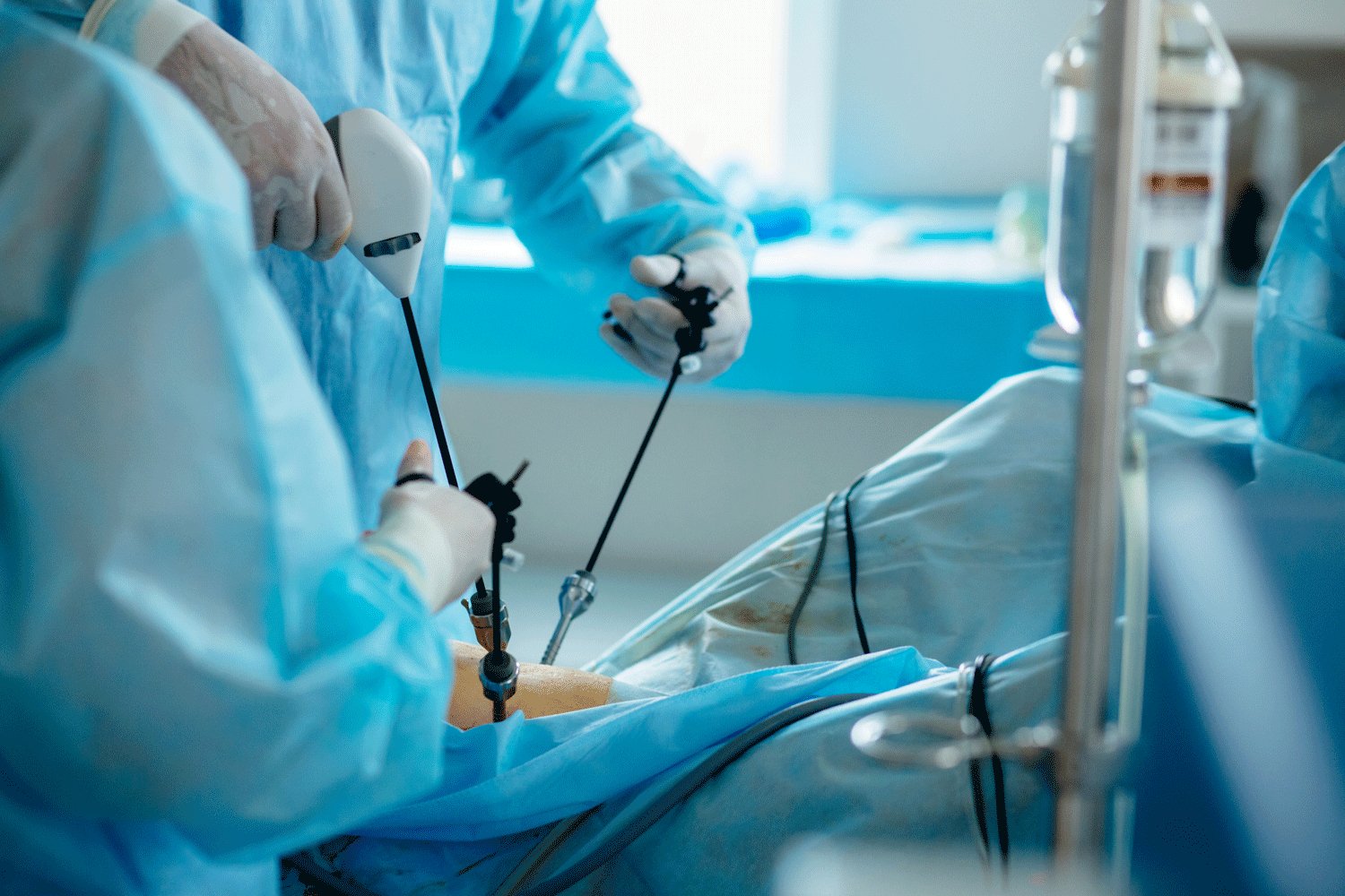 Laparoscopic Hernia repair